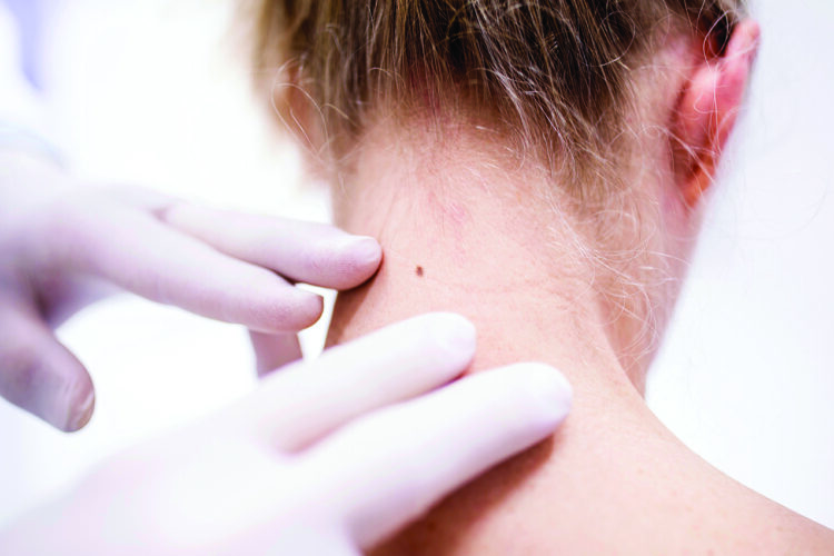 What Are The Warning Signs Of Skin Cancer?